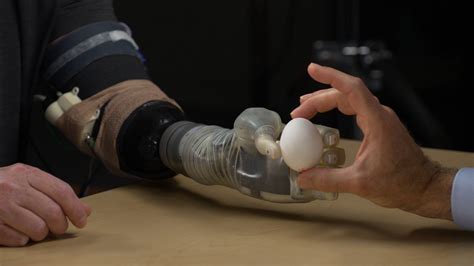 Feb 18, 2013 · In January 2013, a 5-year-old boy who was born without fingers on one hand was given a customizable 3-D printed prosthetic hand, built for only $150 in parts. 3-D printing, by which a 3-dimensional object is created by successive layering of horizontal cross-sections of the object as dictated by a computer file, is an inexpensive method to produce such customized items. 